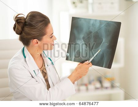 Medical Doctor Woman Pointing On Fluorography