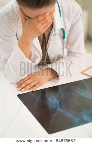 Stressed Medical Doctor Woman With Fluorography In Office
