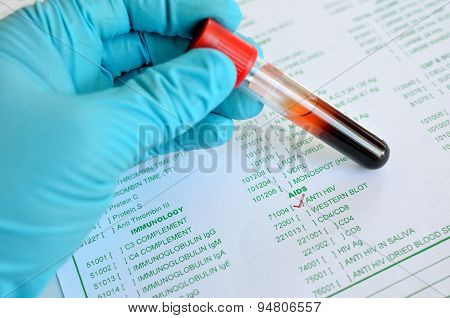 Blood for HIV testing