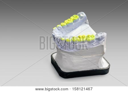 Technical shots of model on a dental prothetic laboratory