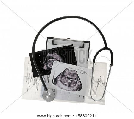 Ultrasound scan of baby and stethoscope on white background