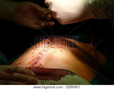 Cirurgia de extremidades