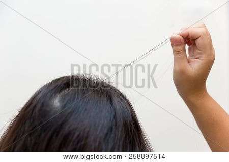 Hair Pulling Disorder Or Trichotillomania In Teenager Women Mental Health Problem.