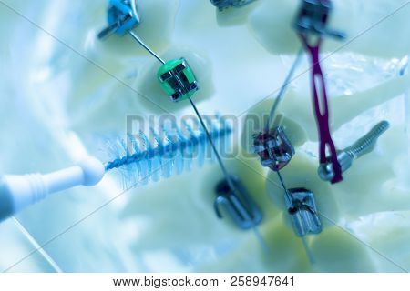 Interdental Teeth Brackets Clean