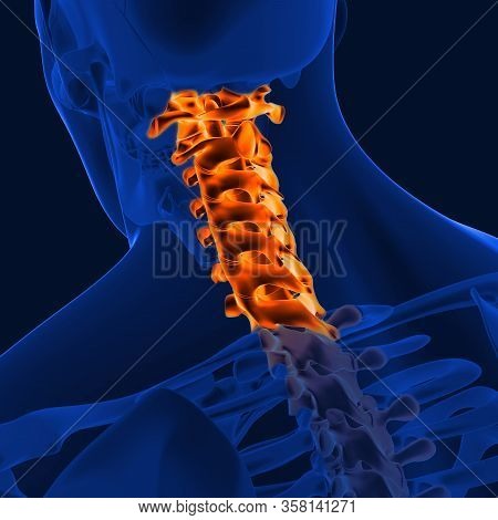 Joint Pain Can Be Caused By Injury Affecting Any Of The Ligaments, Bursae, Or Tendons Surrounding Th