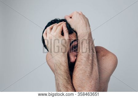 Young Man Isolated Over Background. Sick Ill Mad Guy Look Straight Through Hands. Cover Face With Th