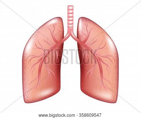 Human Lung Cancer Diagram Isolated. Respiratory Illness Cancer Graphics. Realistic Lung Anatomy. Vec