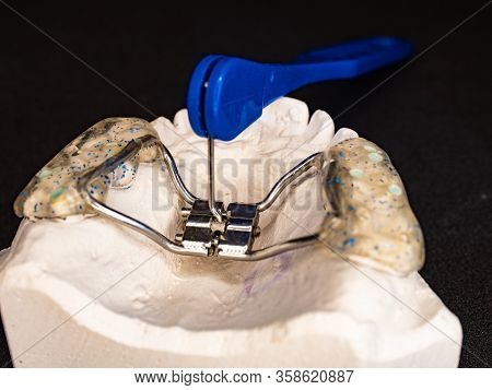 Dentist Test Setting Of Palatal Braces For Young Patient. Jaw Correction In Youth Is Very Popular Co
