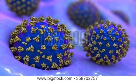 Coronaviruses Sars-cov-2 Infecting Human Alveoli Cells, The Concept Of Covid-19 Spread And Infection