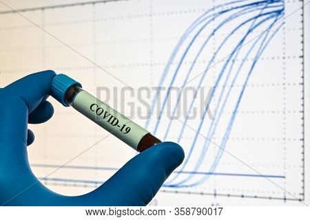 Pcr Detection Of Coronavirus Sars-cov-2. Blood Sample For Research On Covid-19.