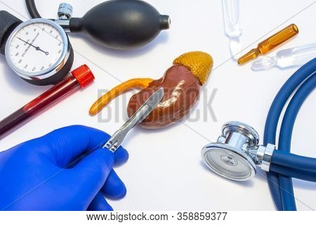 Concept Photo Of Kidney Surgery, Operation Of Kidney Resection Or Nephrectomy. Doctor With Scalpel I