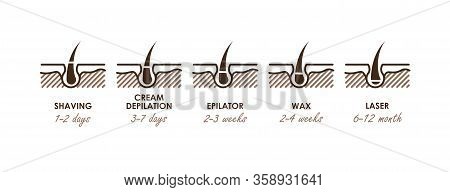 Different Methods Of Hair Removal. Shaver, Depilatory Cream, Epilator, Wax And Laser. Types Of Epila