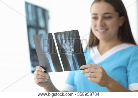 Close-up Of Female Hands Holding Wrist Skiagram. Smiling Doctor Traumatologist Examining Shadowgraph