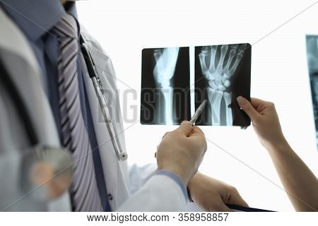 Close-up Of Female Hand Holding Patient Wrist Skiagram. Experienced Traumatologist Showing On Trauma