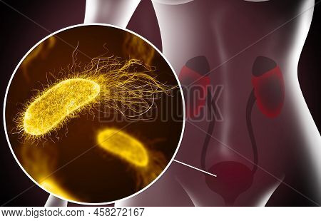 Illustration Of Woman Suffering From Cystitis. Urinary Infection