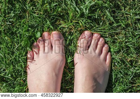 Bare Feet On Green Grass. Selfie. Female Feet On The Green Grass. Rustic Lifestyle. View From Above.
