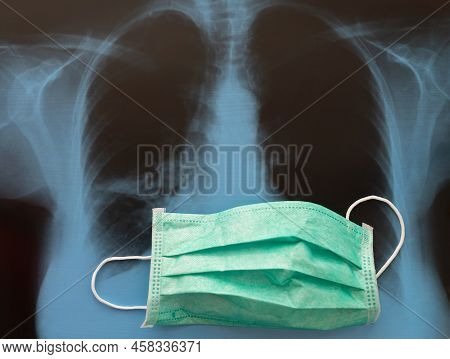 Lungs On X-ray Film And Medical Mask, Health Care Roentgen Background, Pneumonia Prevention Concept
