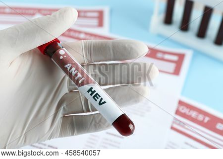 Scientist Holding Tube With Blood Sample And Label Anti Hev Near Laboratory Test Form, Closeup