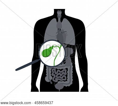 Gallbladder Anatomical Poster Or Banner For Education. Scheme Of Biliary Ducts. Part Of The Digestiv