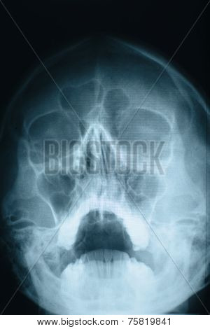 Head Xray
