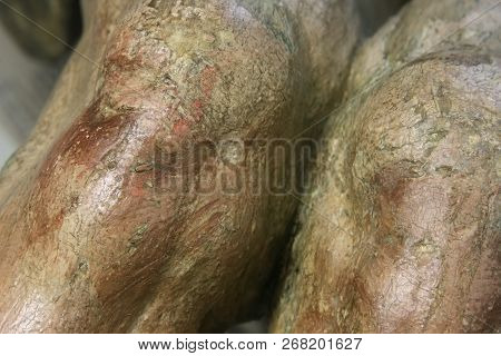 Restoration: Close Up. Conservation Of Paintings. Conservation Of Sculptures