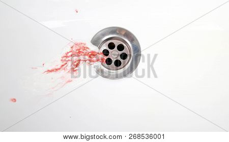 Toothpaste With Blood In A Ceramic Sink. Bleeding Gums. Close Up