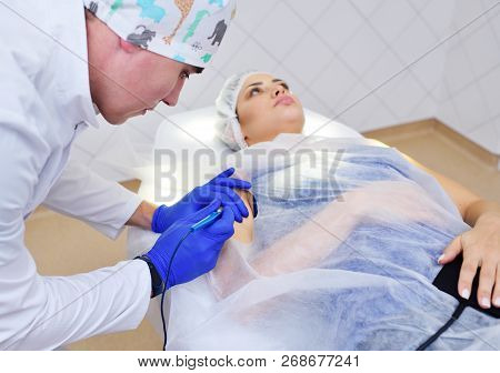 The Surgeon Beautician Removes The Patient's Woman Birthmark Or Birthmark On The Hand With A Radio W