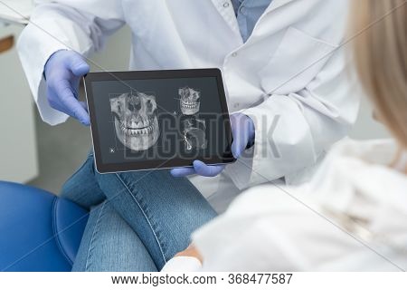Dental Consultation In Clinic. Dentist Showing Teeth X-ray On Digital Tablet Screen. 3d Tomography T