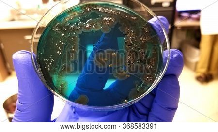 Salmonella Black Colonies And Pseudomonas On Chromogenic Agar