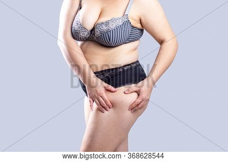 Woman Real Body Plus size Model in lingerie posign and showing fat on leg, imperfect nonideal