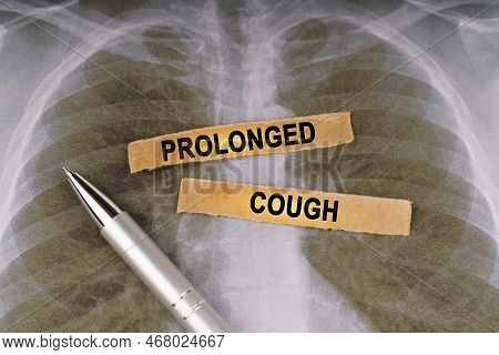 Medical Concept. On A Human Chest X-ray, A Pen And Strips Of Paper Labeled - Prolonged Cough