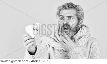 Guy Blow Out Nose In Paper With Blood. Allergic Reaction. Nose Bleed. Against Virus Or Bacteria. Flu