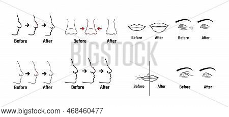 Plastic Surgery And Clinic With Lifting Plasty And Liposuction Sketch Icons Set Flat Isolated Vector
