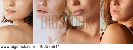 Lips, Chins, Shoulders. Set Of Cropped Images Of Diverse Women With Well-kept Young Skin Without Mak