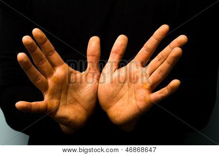 Tied Hands