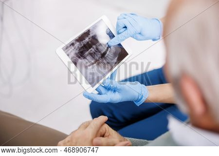 Doctor Showing Jaw X-ray On Tablet Computer To Patient Sitting In Dental Chair At Dentist Office
