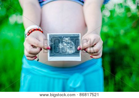 Happy Pragnant Women Outdoor In The Garden