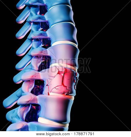 3d image of human spinal