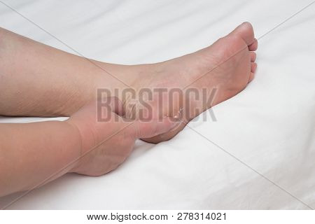 Woman Smears Heel On Her Leg With Healing Ointment For The Treatment Of Heel Spurs, Fascia, Copy Spa