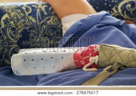 Bedridden Patient With A Scratching Protection On His Hand.