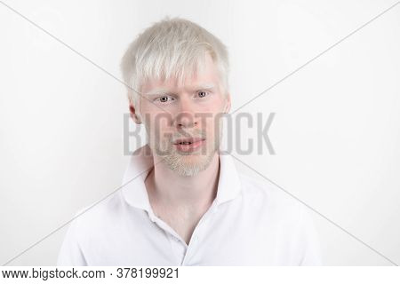 Albinism Albino Man In Studio Dressed T-shirt Isolated On A White Background. Abnormal Deviations. U