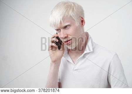 Albinism Albino Man White Skin Hair Studio Dressed T-shirt Isolated White Background Abnormal Deviat