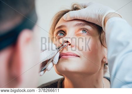 Otolaryngologist Examines Womans Nose With Nasal Dilator.