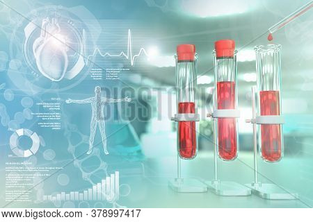 Medical 3d Illustration, Test Tubes Vials In College Office - Blood Test For Red Cell Distribution O