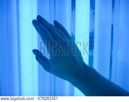 Phototherapy Dermatosis. Treatment Of Skin Diseases - Psoriasis, Ekzemy, Dermatitis, Vitiligo-irradi