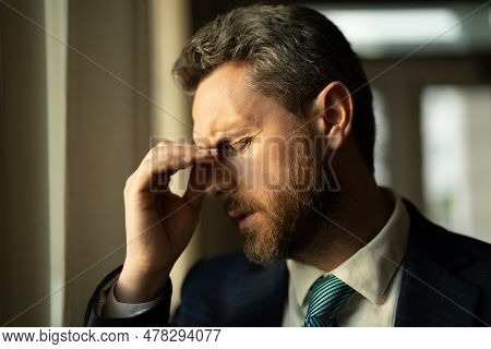 Head Pain Concept. Cephalalgia And Migraine. Man With Sinus Headache, Tension Or Cluster Headache. H