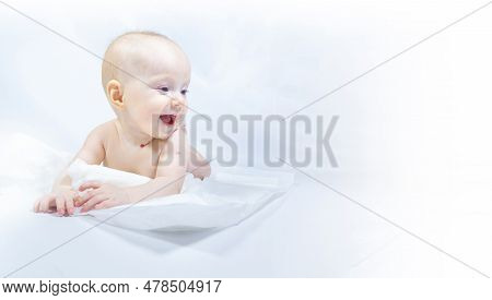 A Baby With A Hemangioma On His Neck Lies On A White Background. Banner With A Copy Space. Profile O