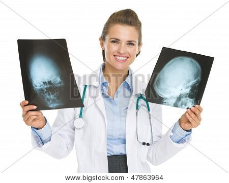 Usmívající se žena doktora drží Fluorography