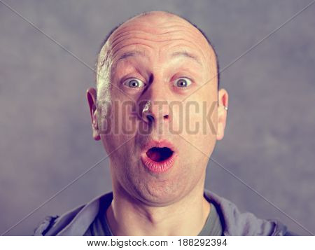 Young Man Looking Amazed In To The Camera