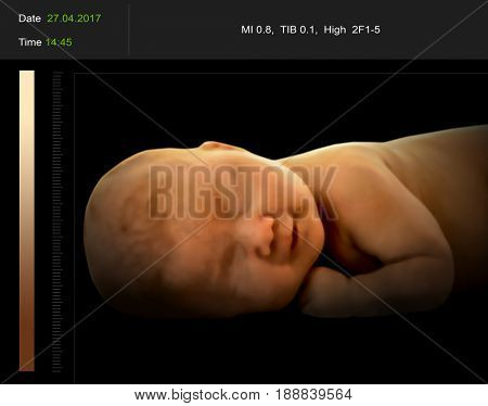 3D ultrasound scan of baby, closeup